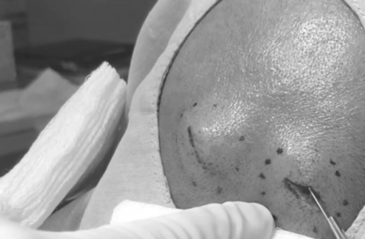 İnanılmaz olay! Başındaki şişlik için doktora gitti, şoke oldu! - Resim: 3