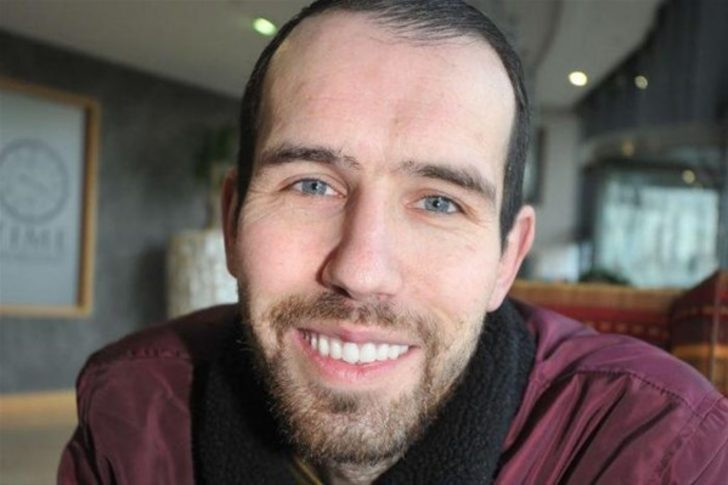 Günde 6 litre kola onu öyle bir hale getirdi ki.. - Resim: 1