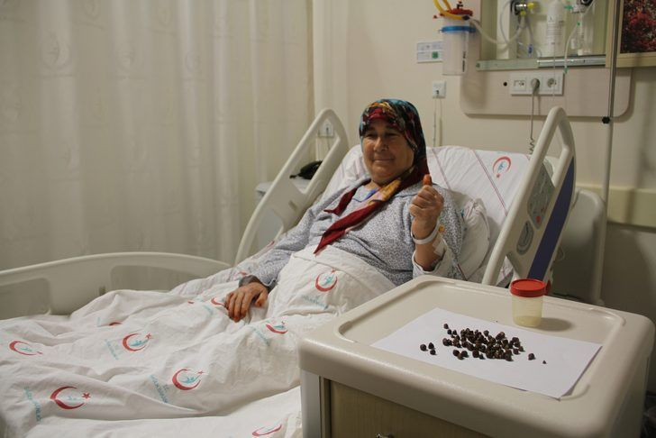 Antalya'da akılalmaz olay Ameliyatla çıkardılar tam 86 tane - Resim: 2