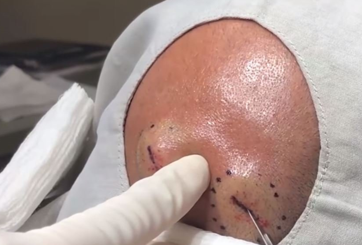 İnanılmaz olay! Başındaki şişlik için doktora gitti, şoke oldu! - Resim: 2