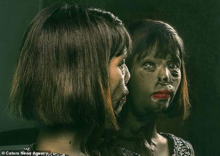 Annesi öldürüldü kendi asit saldırısına uğradı! Nedeni ise... - Resim: 1