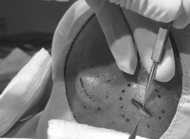 İnanılmaz olay! Başındaki şişlik için doktora gitti, şoke oldu! - Resim: 4