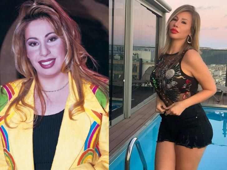 Melis Sezen Pınar Deniz Gülsim Ali'nin estetiksiz hallerine bakın! Ünlüleri eski hallerini gören tanıyamadı - Resim: 2