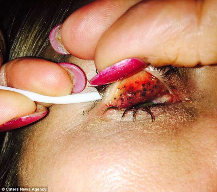 25 yıldır sürdüğü rimeli temizlemeyince az kalsın kör oluyordu - Resim: 2