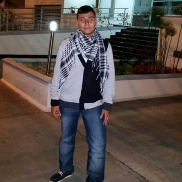 Kulağını ve burnunu kesti! Çılgın değişim - Resim: 2