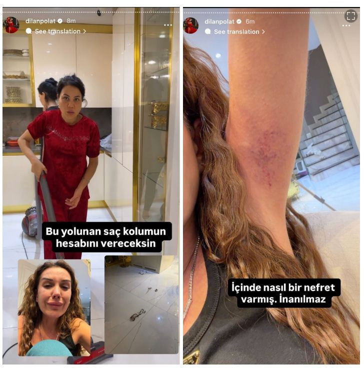 Dilan Polat ablası Sıla Doğu'dan dayak yedi! Saçları koptu, kolu morardı - Resim: 3