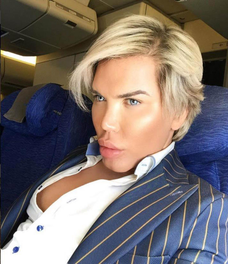 Rodrigo Alves bu sefer Brezilya kalçası yaptırdı - Resim: 1