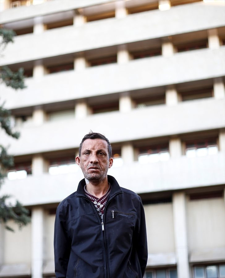 7 yıl geçti! Türkiye'nin ilk yüz nakli olan Uğur Acar'ın son haline bakın - Resim: 3