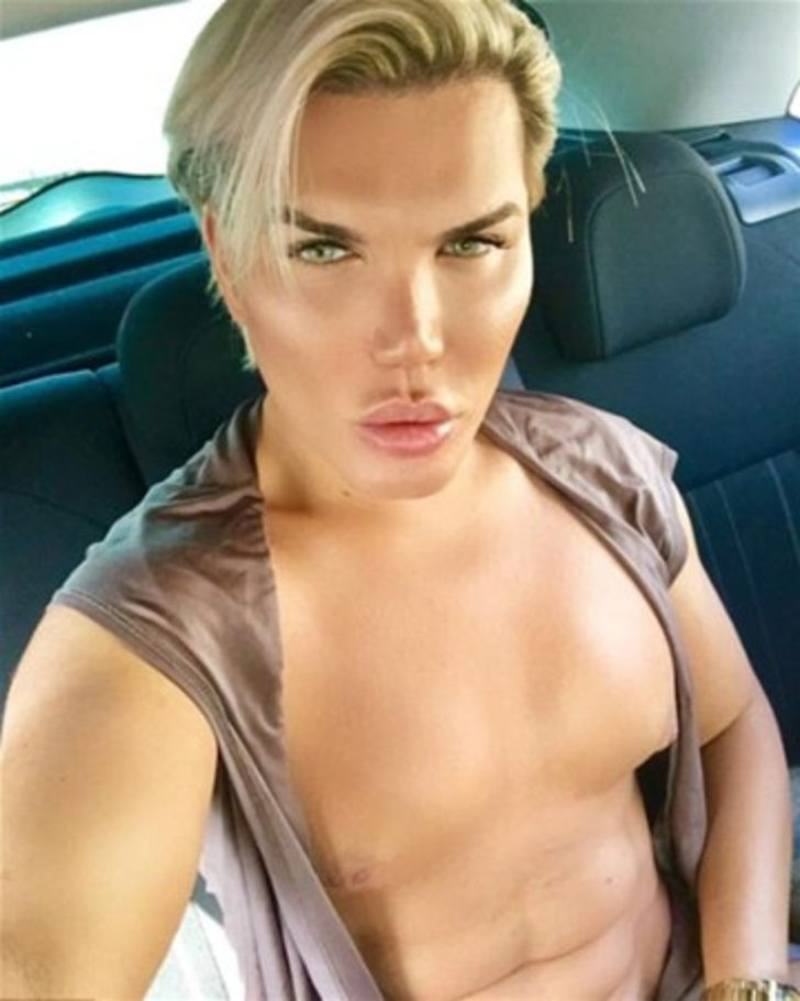 Rodrigo Alves bu sefer Brezilya kalçası yaptırdı - Resim: 2