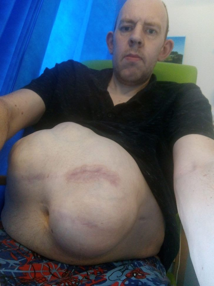 5 yılda bu hale geldi! Hamile gibi görünüyor - Resim: 3