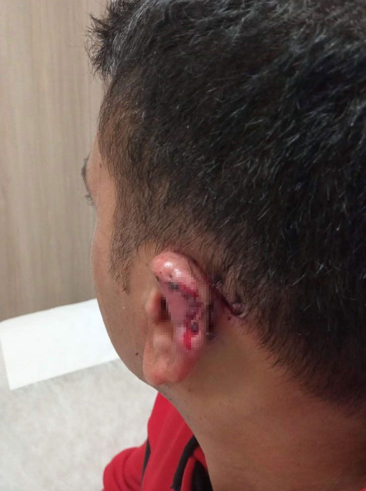 Kavgada kopan kulak parçasını martı kaptı - Resim: 3