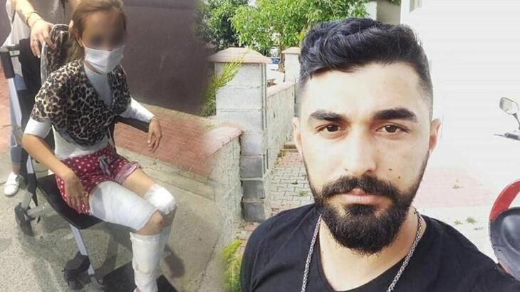 İstanbul'da kızgın bıçakla eşini yakıp zorla ilişkiye girdi! Anlattıkları kan dondurdu - Resim: 1