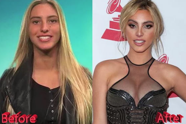 Değişimine kimse inanamadı! Son hali bomba - Resim: 1