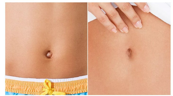 Şimdi bu estetikler moda! İşte acayip yerlere düzeltmeler - Resim: 1