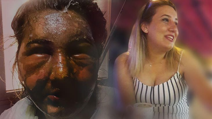 Eski eşini kızgın yağ ile yakmıştı! İşte istenen ceza - Resim: 4