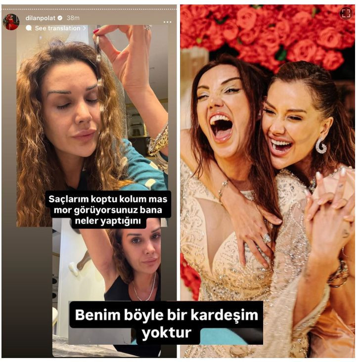 Dilan Polat ablası Sıla Doğu'dan dayak yedi! Saçları koptu, kolu morardı - Resim: 4