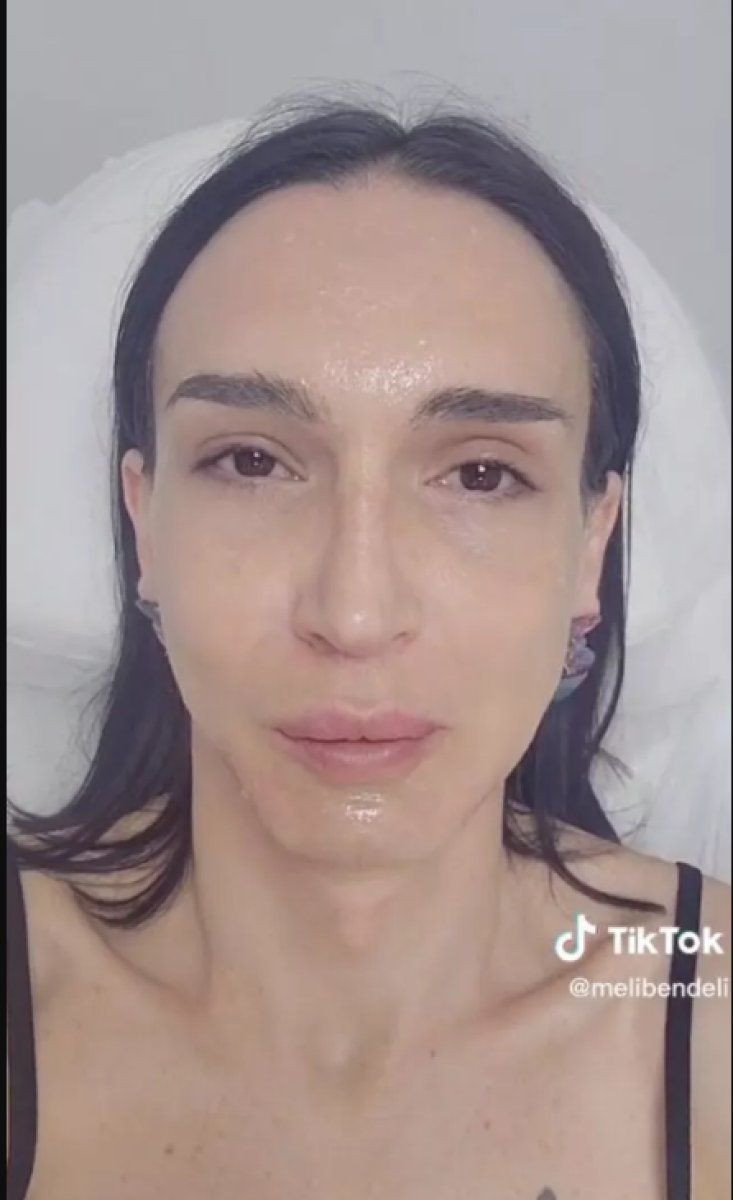 Çukur'un Timsah Celil'i cinsiyet değiştirmişti dolgu yaptırdığı anları paylaştı - Resim: 4