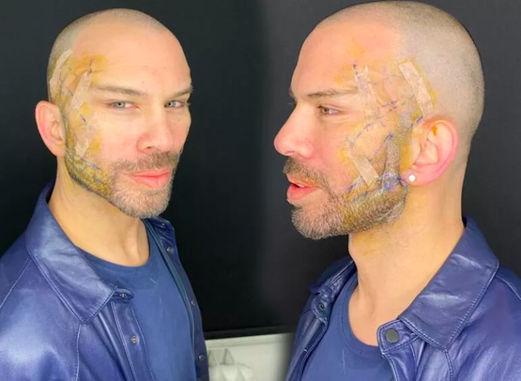 Berksan 3 ay sonra ortaya çıktı! Fransız askısıyla bambaşka biri oldu son haline bakın - Resim: 3