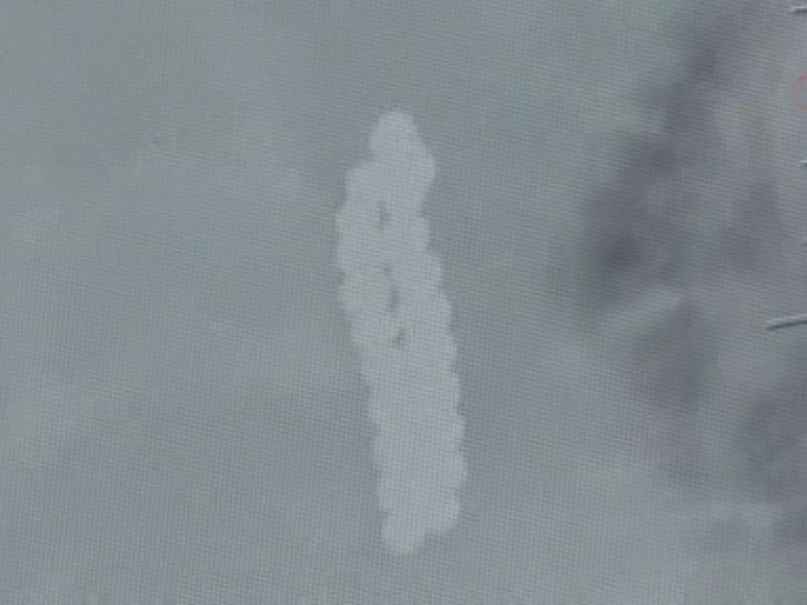 Karın ağrısıyla hastaneye götürdüler çocuğun midesinden çıkanlar hayret verici! - Resim: 4