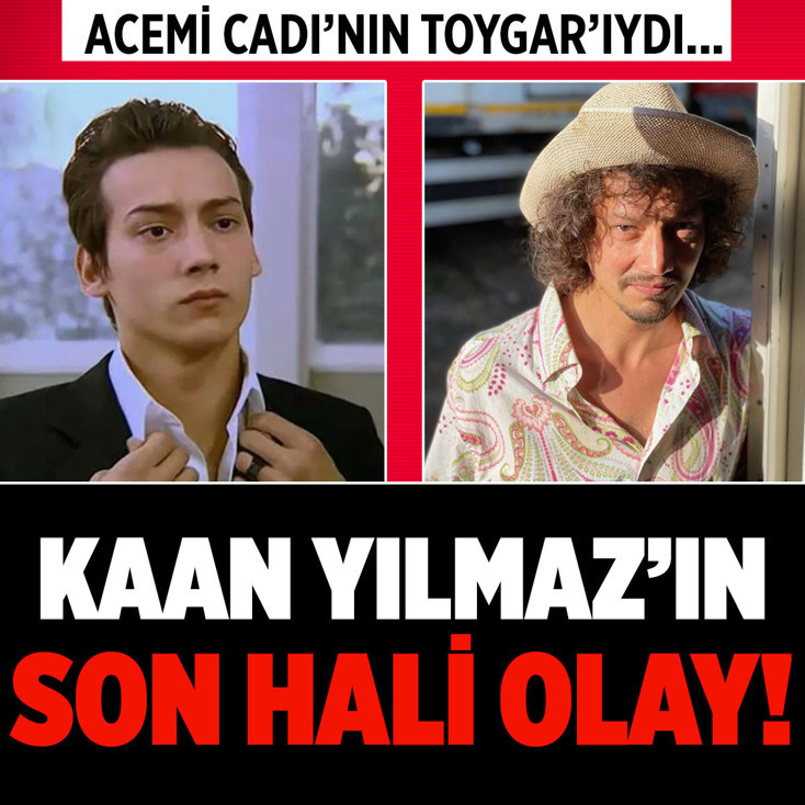 Acemi Cadı dizisinin yıldızıydı! Kaan Yılmaz'ın son hali herkesi şaşırttı...