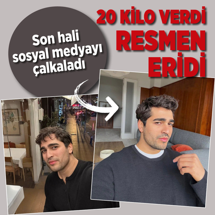 Mert Ramazan Demir 20 kilo verdi eridi bitti! Son hali sosyal medyayı çalkaladı
