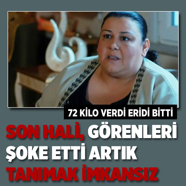 72 kilo verdi, tanımak imkansız! Esin Gündoğdu'nun inanılmaz değişimi...