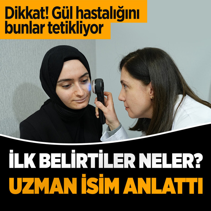 Yüzdeki kızarıklık ve yanma gül hastalığının ilk belirtisi