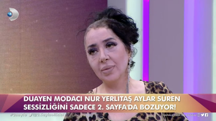 Nur Yerlitaş bir anda bandanasını çıkardı canlı yayında herkesi şoke etti - Resim: 4