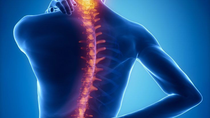 Skolyoz nedir skolyoz dereceleri tedavisi nasıl olur? - Resim: 3