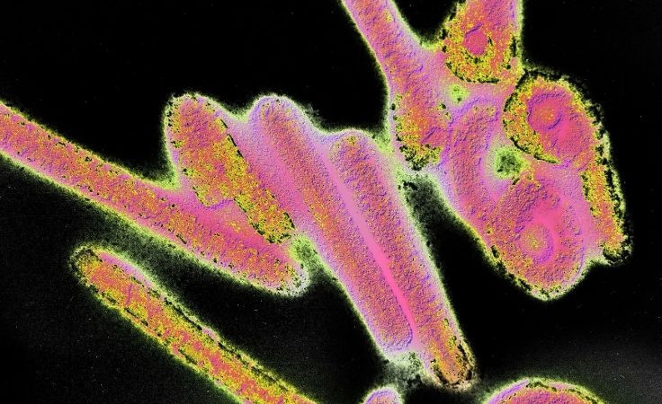 Biri bitmeden biri başlıyor! Şimdi de Marburg virüsü paniği başladı! - Resim: 4