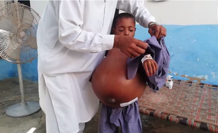 Korkunç olay! Sık sık karnı ağrıyordu 1 yılda bu hale geldi - Resim: 1