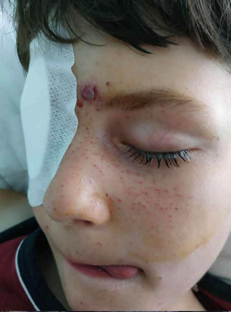 Konya'da merak edip duvar deliğinden bakan Arda gözlerinden oldu - Resim: 2