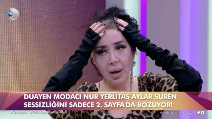 Nur Yerlitaş bir anda bandanasını çıkardı canlı yayında herkesi şoke etti - Resim: 3