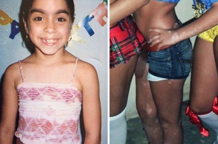 Görenler hayrete düşüyor! Hastalığını sanata çevirdi - Resim: 1