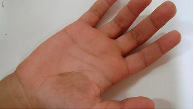 Bir gecede ortaya çıkıyor ölümcül olabiliyor! Şeytan kınası neyin habercisi? - Resim: 2