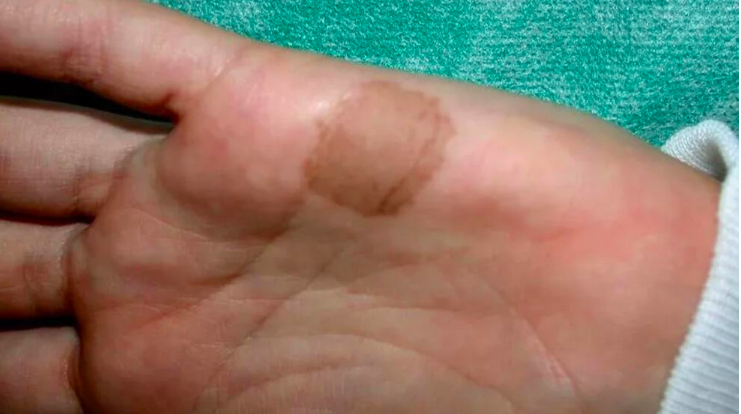 Bir gecede ortaya çıkıyor ölümcül olabiliyor! Şeytan kınası neyin habercisi? - Resim: 1