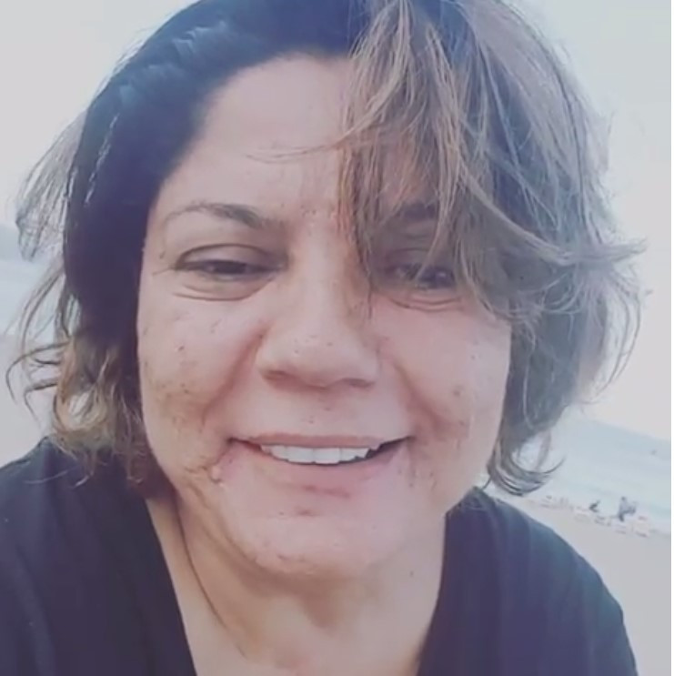 İzel'in son haline bakın ne oldu öyle çok şaşıracaksınız - Resim: 4