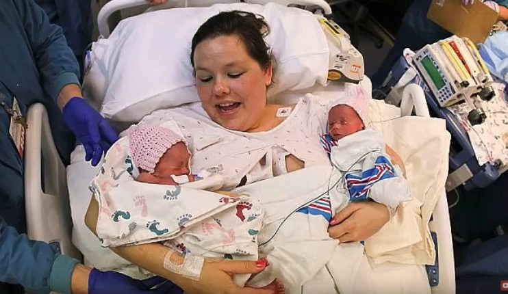 Bebekler doğduğunda olanları görenler gözlerine inanamadı  - Resim: 3