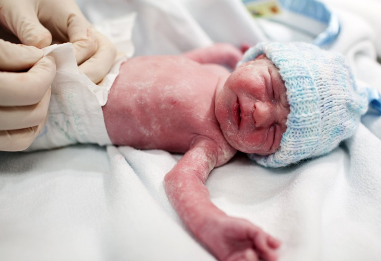 Sünnet hakkında yıllar sonra ortaya çıkan gerçek! Bu dönemde yaptırmak... - Resim: 3