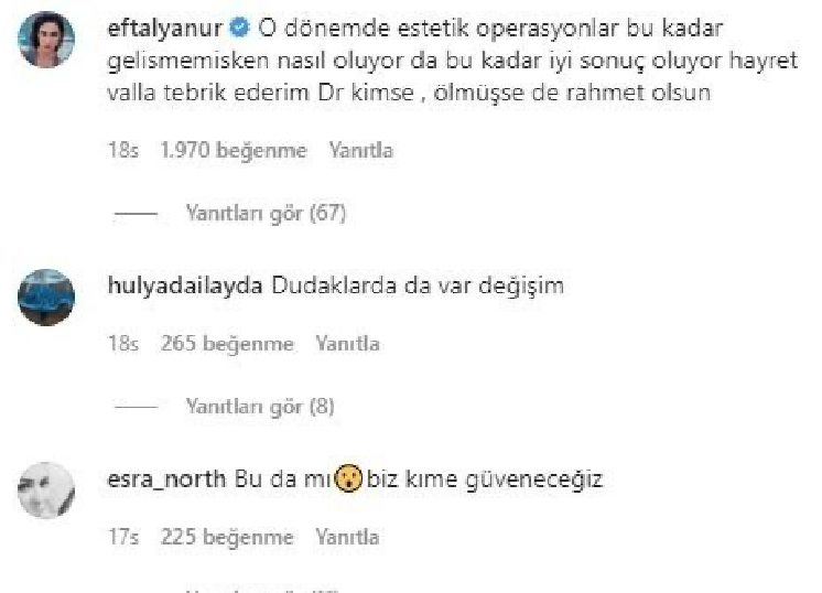 Türkan Şoray’ın estetiksiz halini görenler tanıyamadı! Doktorunu tebrik ettiler - Resim: 4