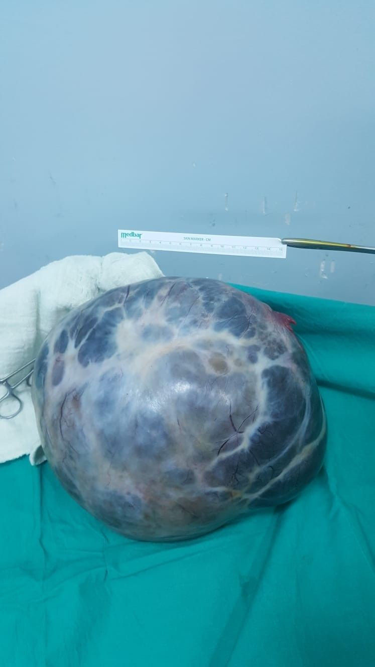 Kabızlık sandı ama gerçek bambaşka çıktı! Karnından alınanlara bakın - Resim: 4