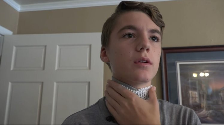 Onu arkadaşlar bir şaka uğruna bu hale getirdi sebebi ise korkunç - Resim: 4