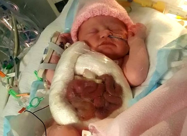 Bu halde dünyaya geldi annesi dehşete düşüp streç filmle... - Resim: 3