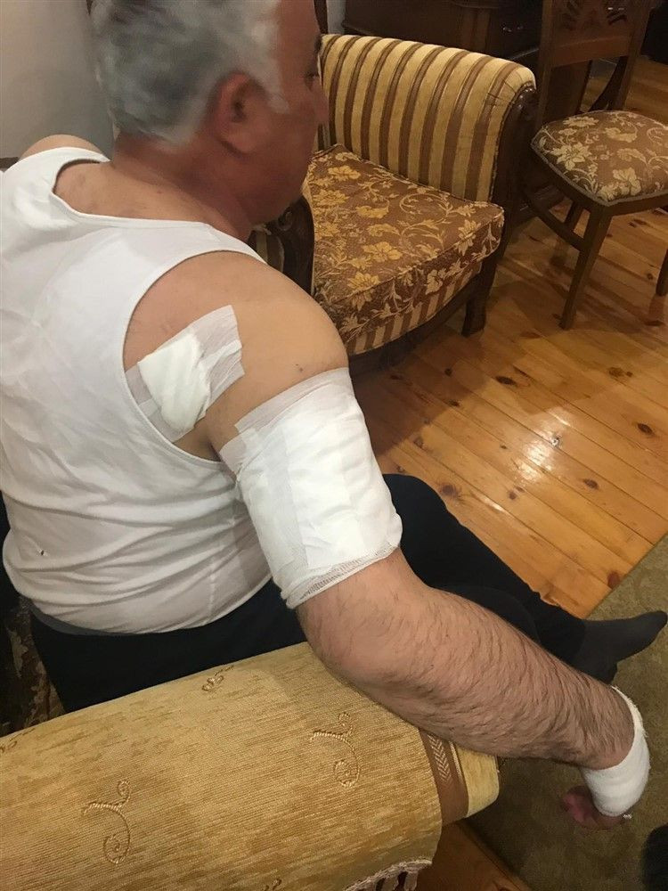 Belediye Başkanına korkunç köpek saldırısı kolunu parçaladı - Resim: 4