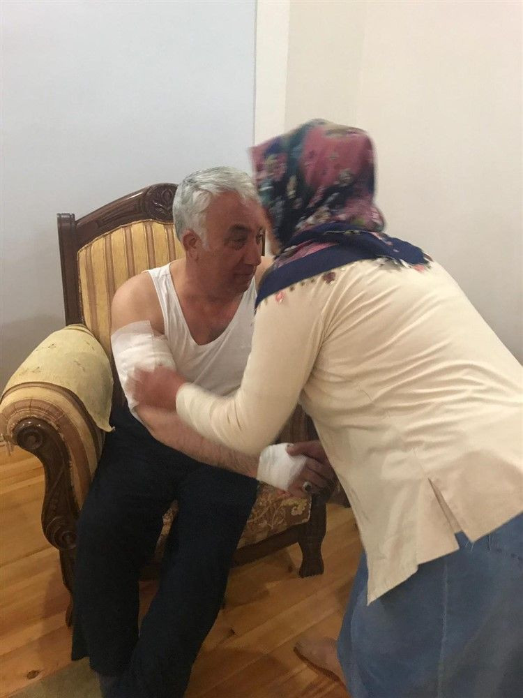 Belediye Başkanına korkunç köpek saldırısı kolunu parçaladı - Resim: 3