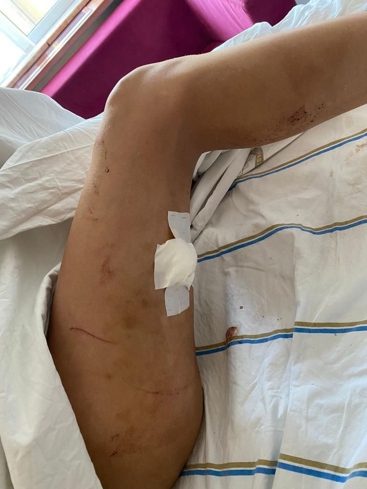 Doktor sevgili Elazığ'da kan dondurdu! Genç kadının akciğeri söndü! Gözlerini oyacağım... - Resim: 3