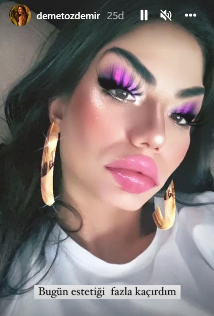 Demet Özdemir'den estetik iddialarına 'filtreli' pozla yanıt: Fazla kaçırmışım! - Resim: 3
