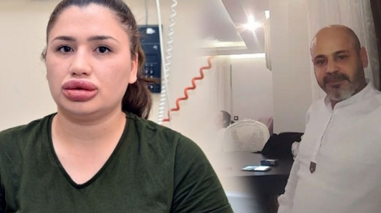 Hemşireyi bu hale getirmişti, yakalandı, ilk sözü bu oldu - Resim: 1