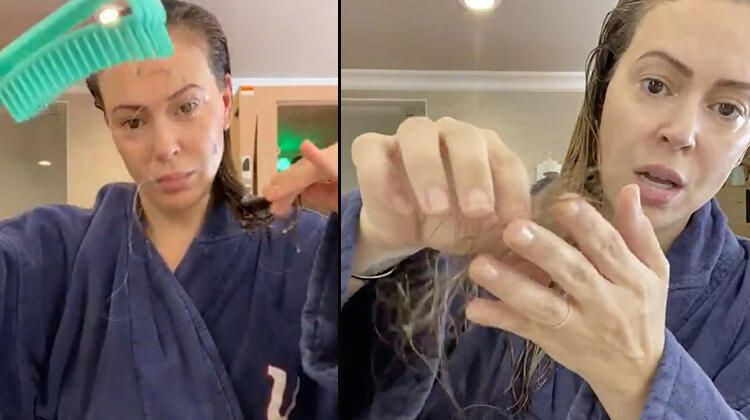 Koronaya yakalanan ünlü oyuncudan şok video! 'Covid-19 yüzünden saçlarım dökülüyor...' - Resim: 1