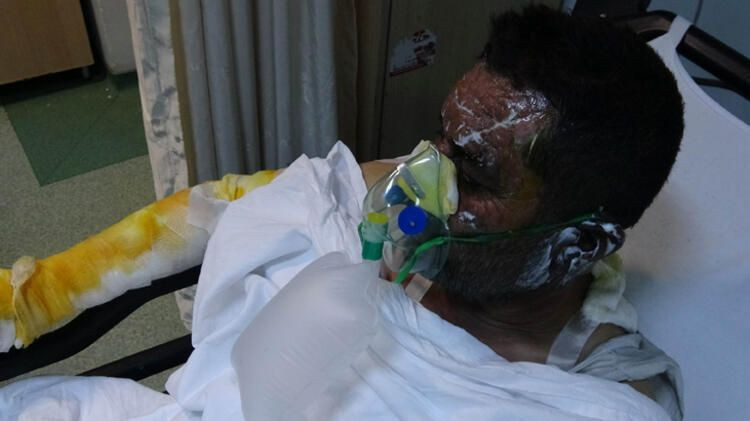 Samsun bu olayı konuşuyor ailesi için kendini riske attı bu hale geldi - Resim: 2